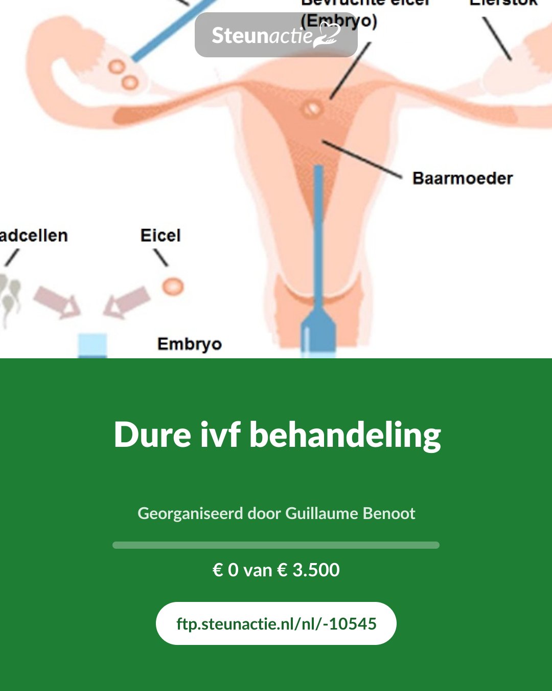 Voorbeeld van de afbeelding