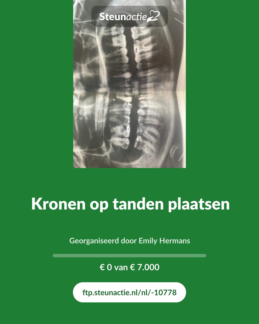 Voorbeeld van de afbeelding