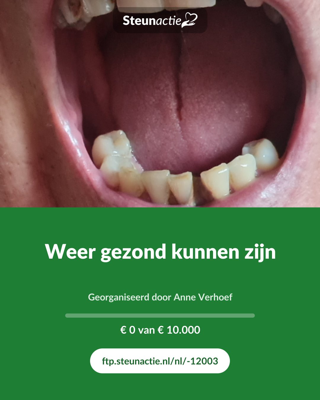 Voorbeeld van de afbeelding