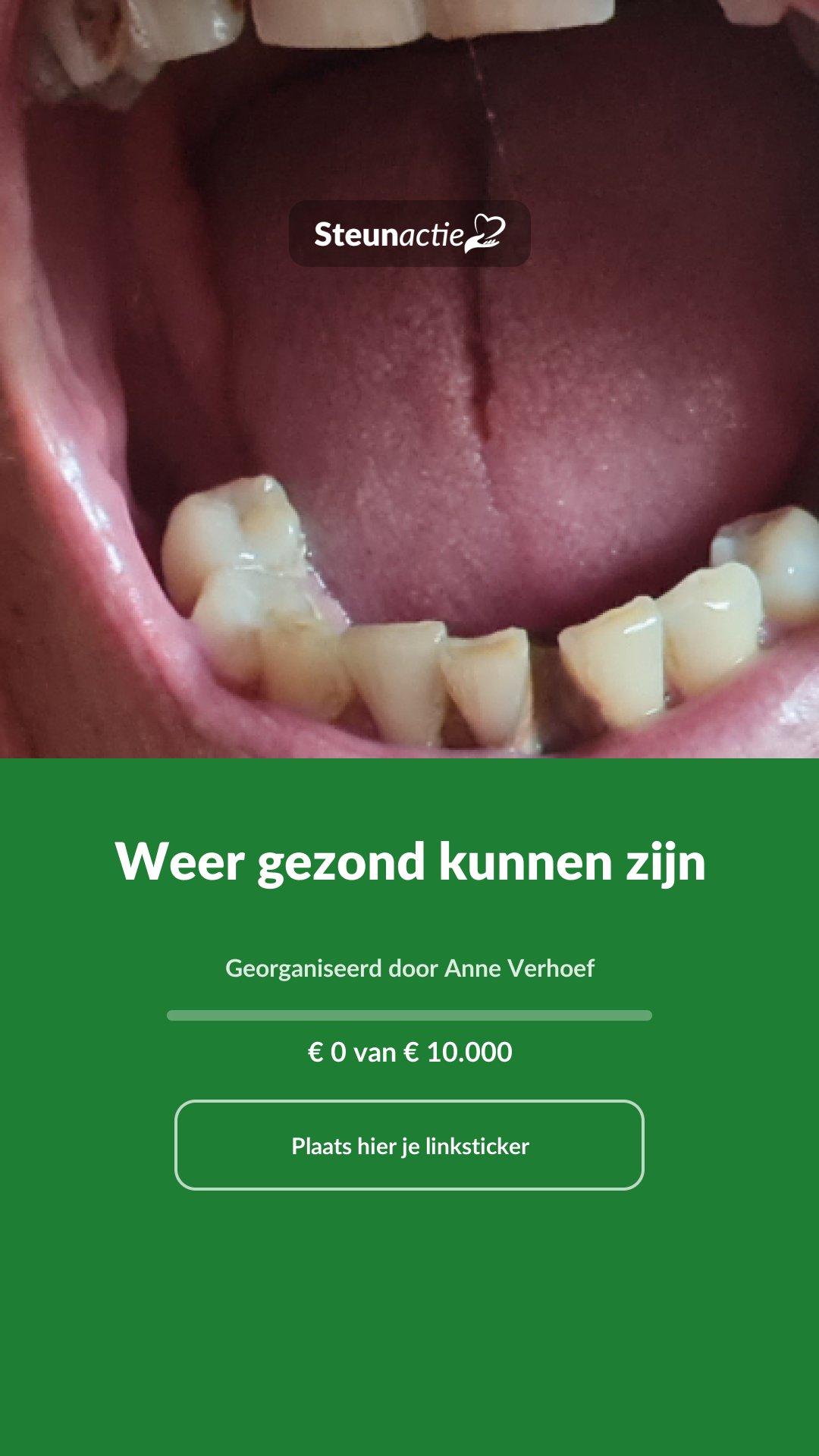 Voorbeeld van de afbeelding