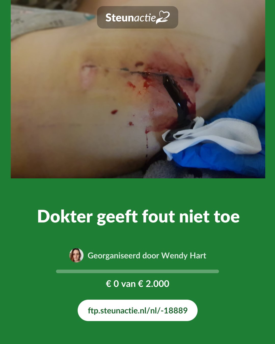 Voorbeeld van de afbeelding