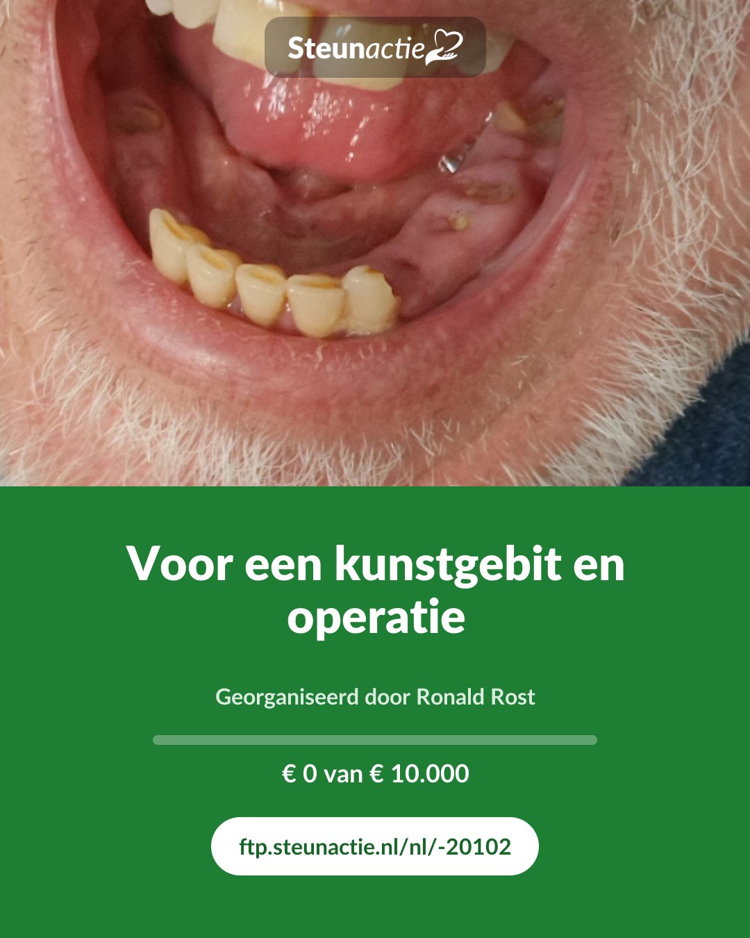 Voorbeeld van de afbeelding