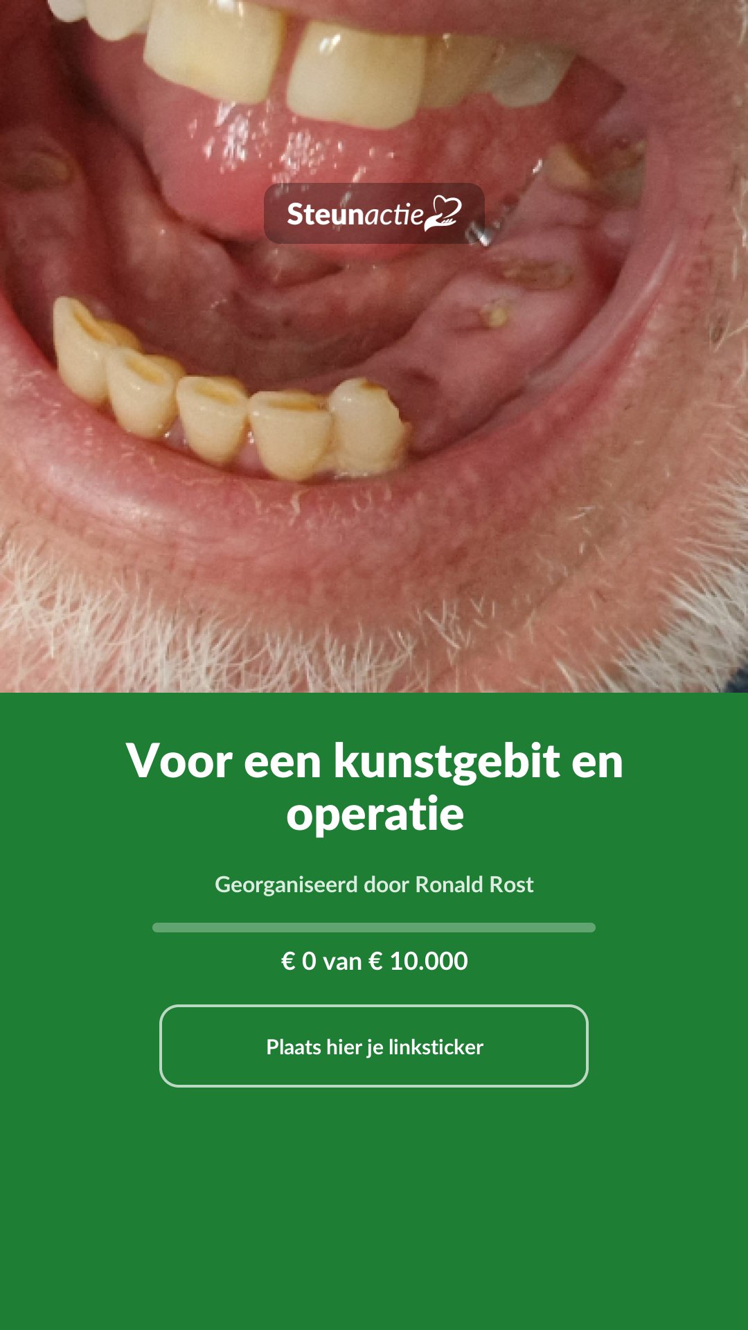Voorbeeld van de afbeelding