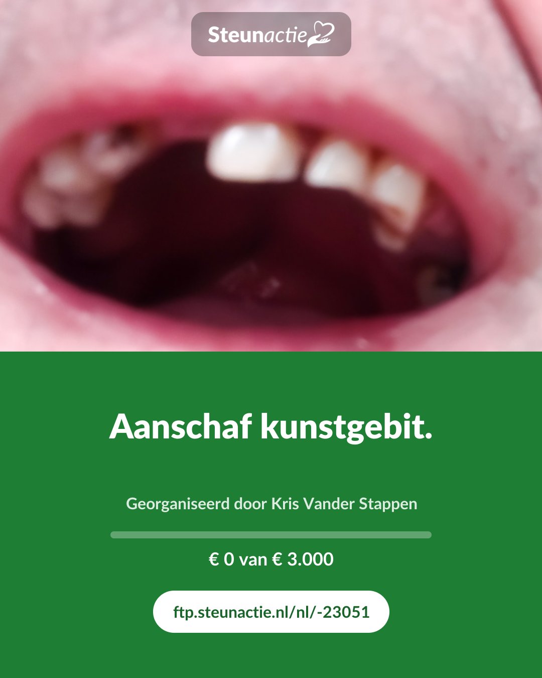 Voorbeeld van de afbeelding