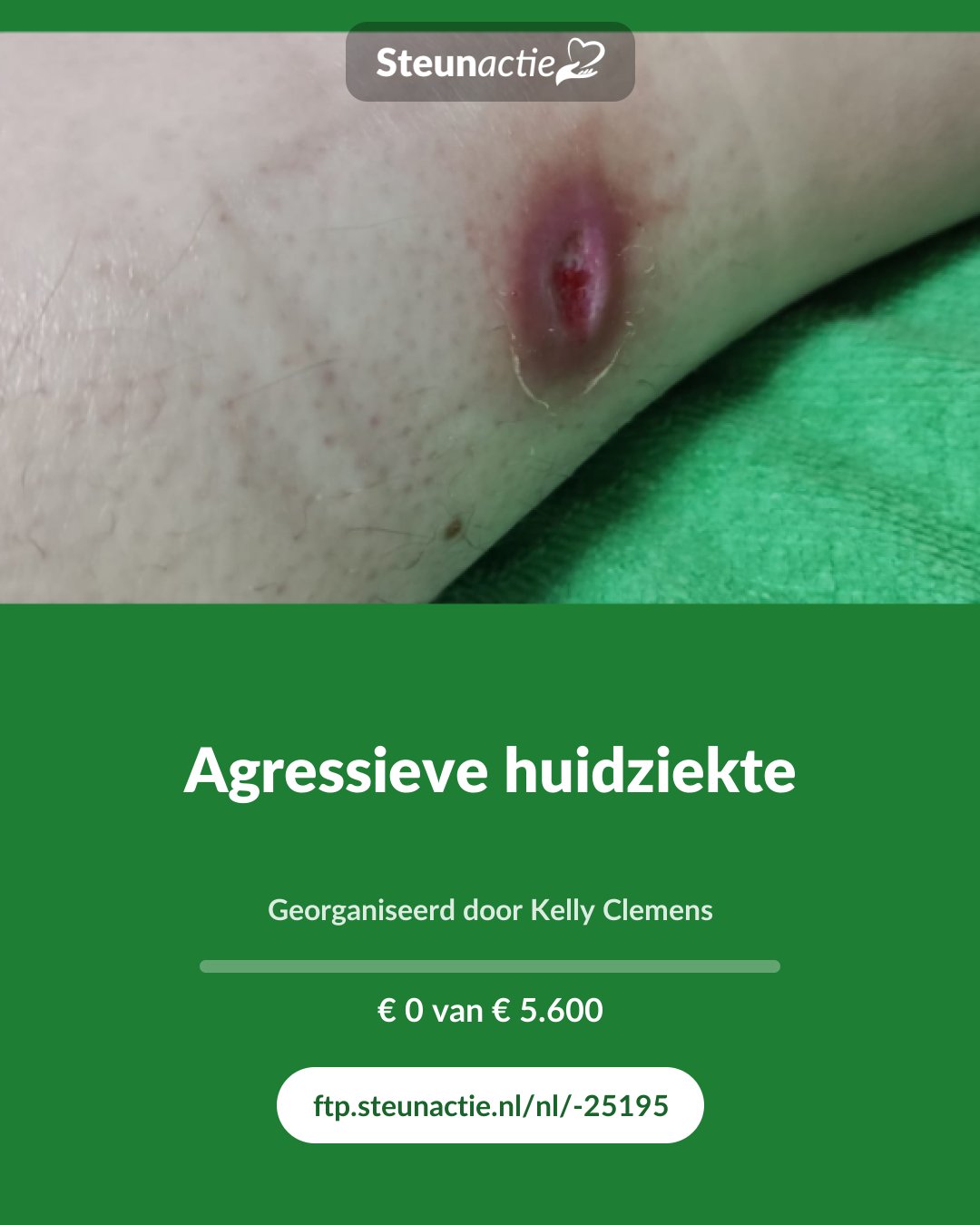 Voorbeeld van de afbeelding