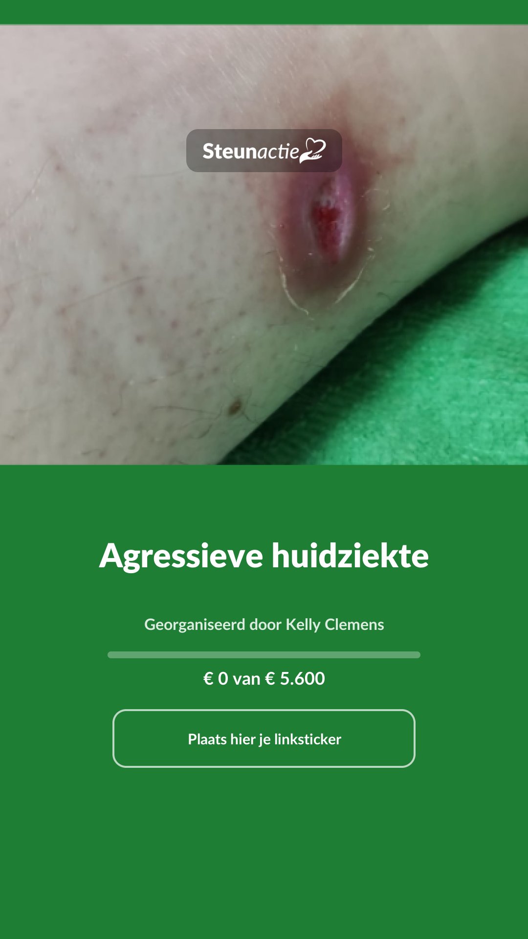 Voorbeeld van de afbeelding