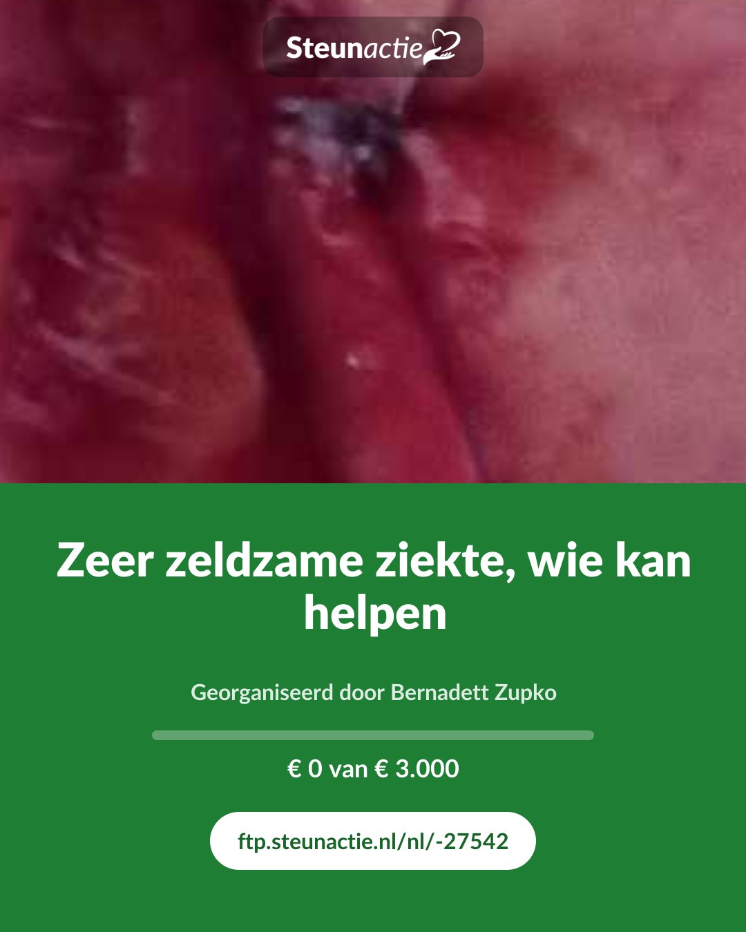 Voorbeeld van de afbeelding