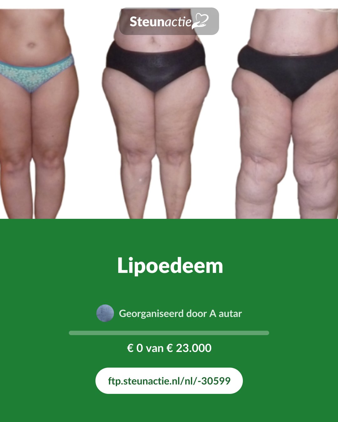 Voorbeeld van de afbeelding
