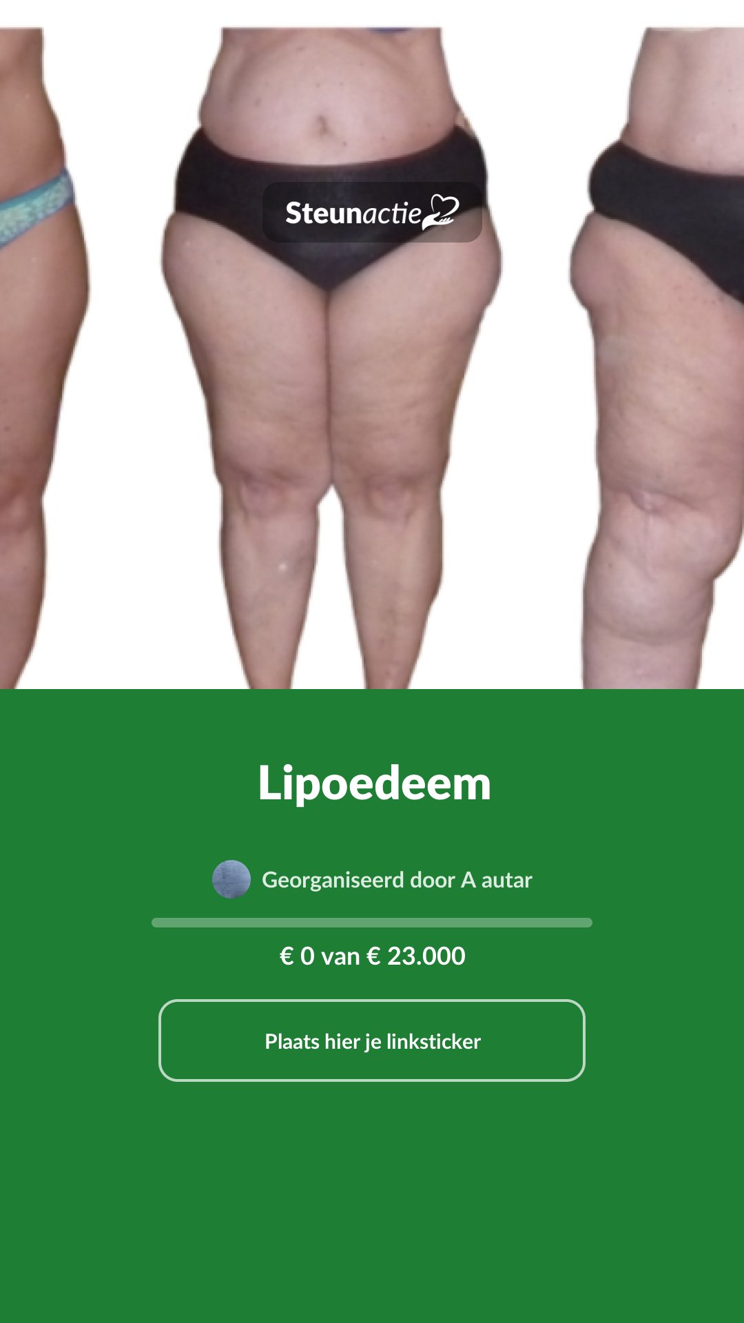 Voorbeeld van de afbeelding