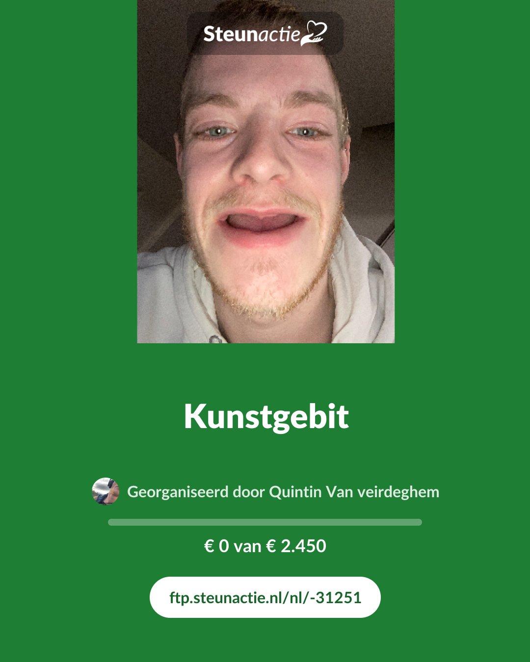 Voorbeeld van de afbeelding