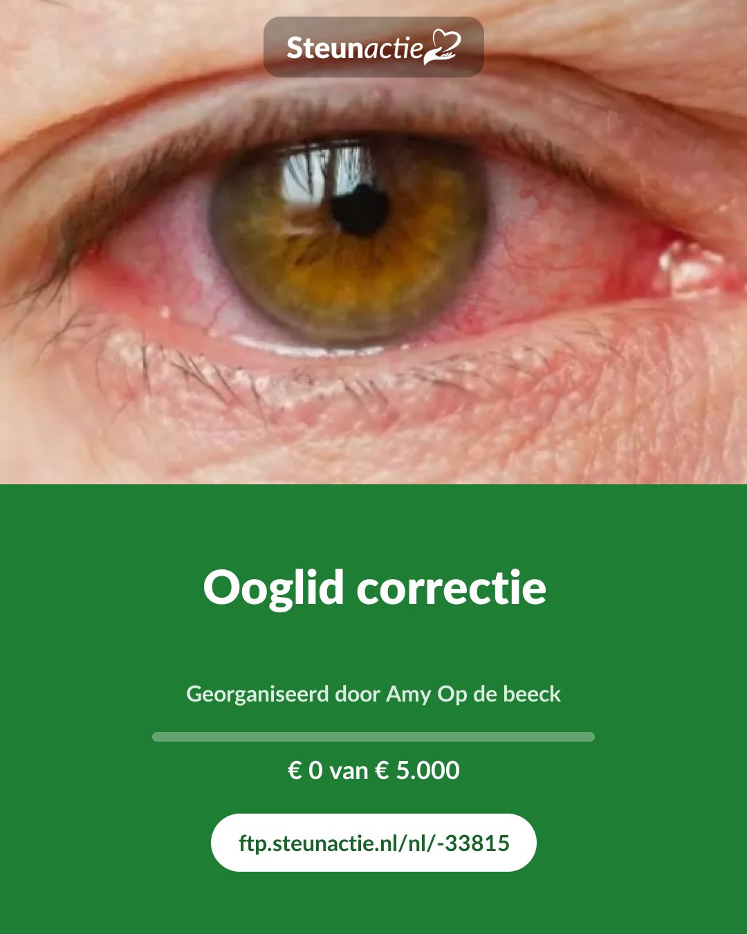 Voorbeeld van de afbeelding