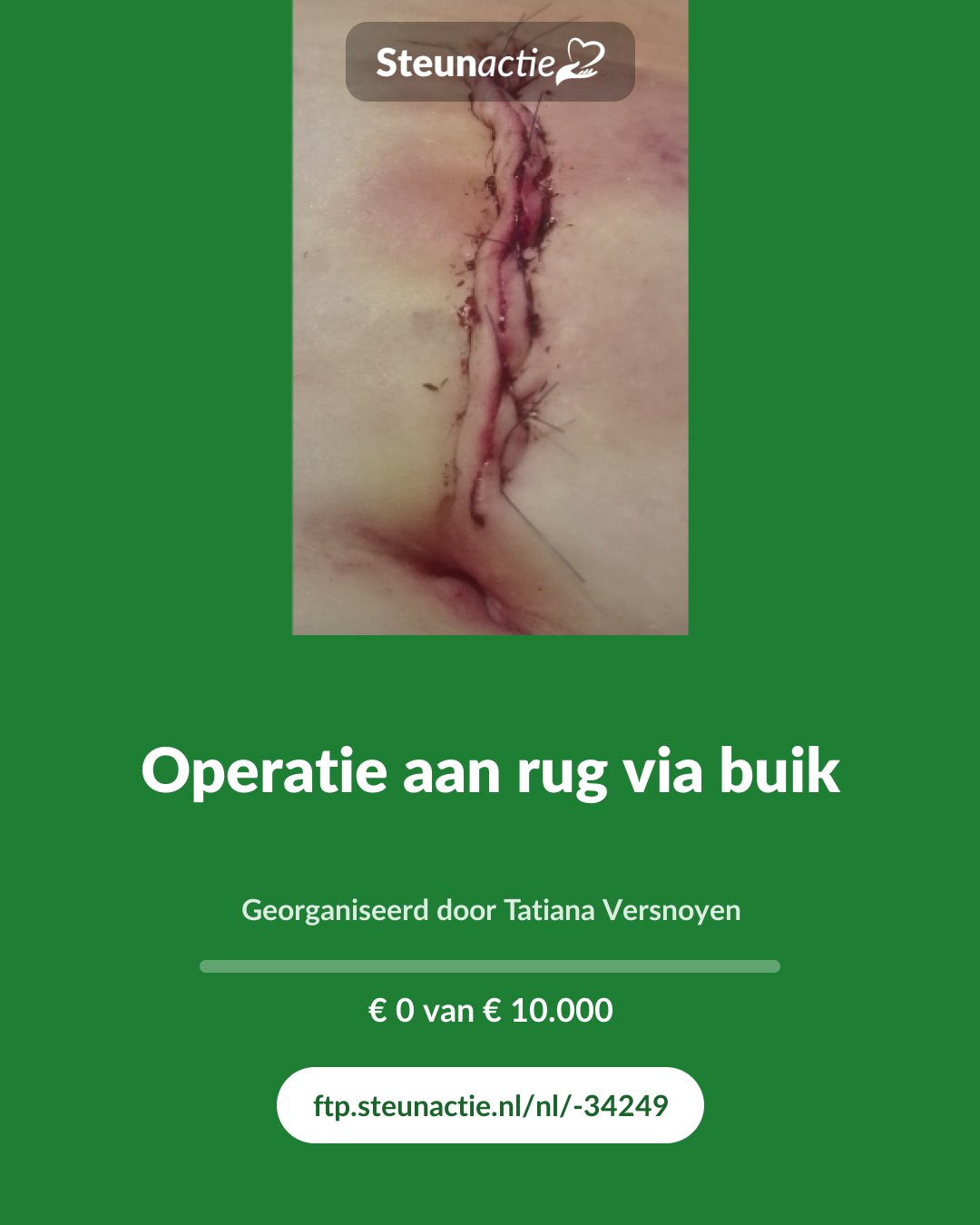 Voorbeeld van de afbeelding