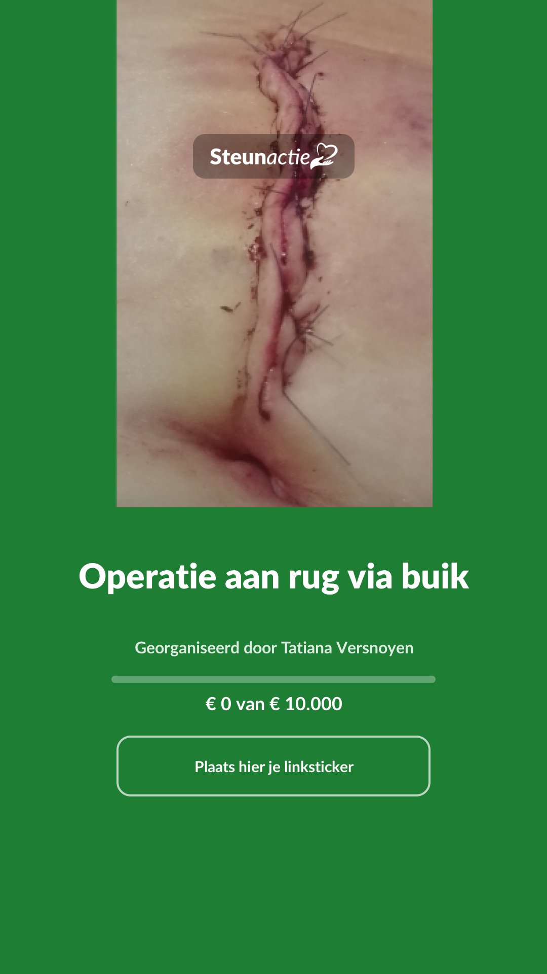 Voorbeeld van de afbeelding