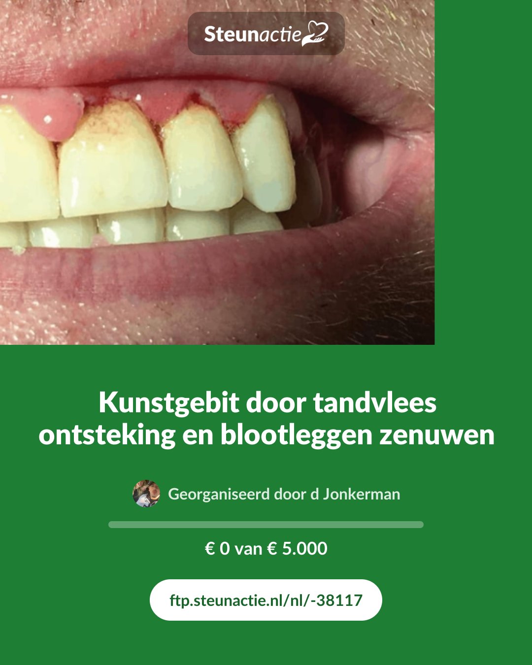Voorbeeld van de afbeelding
