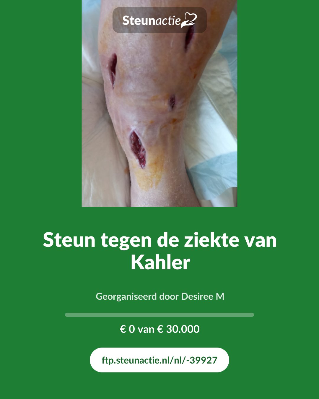 Voorbeeld van de afbeelding