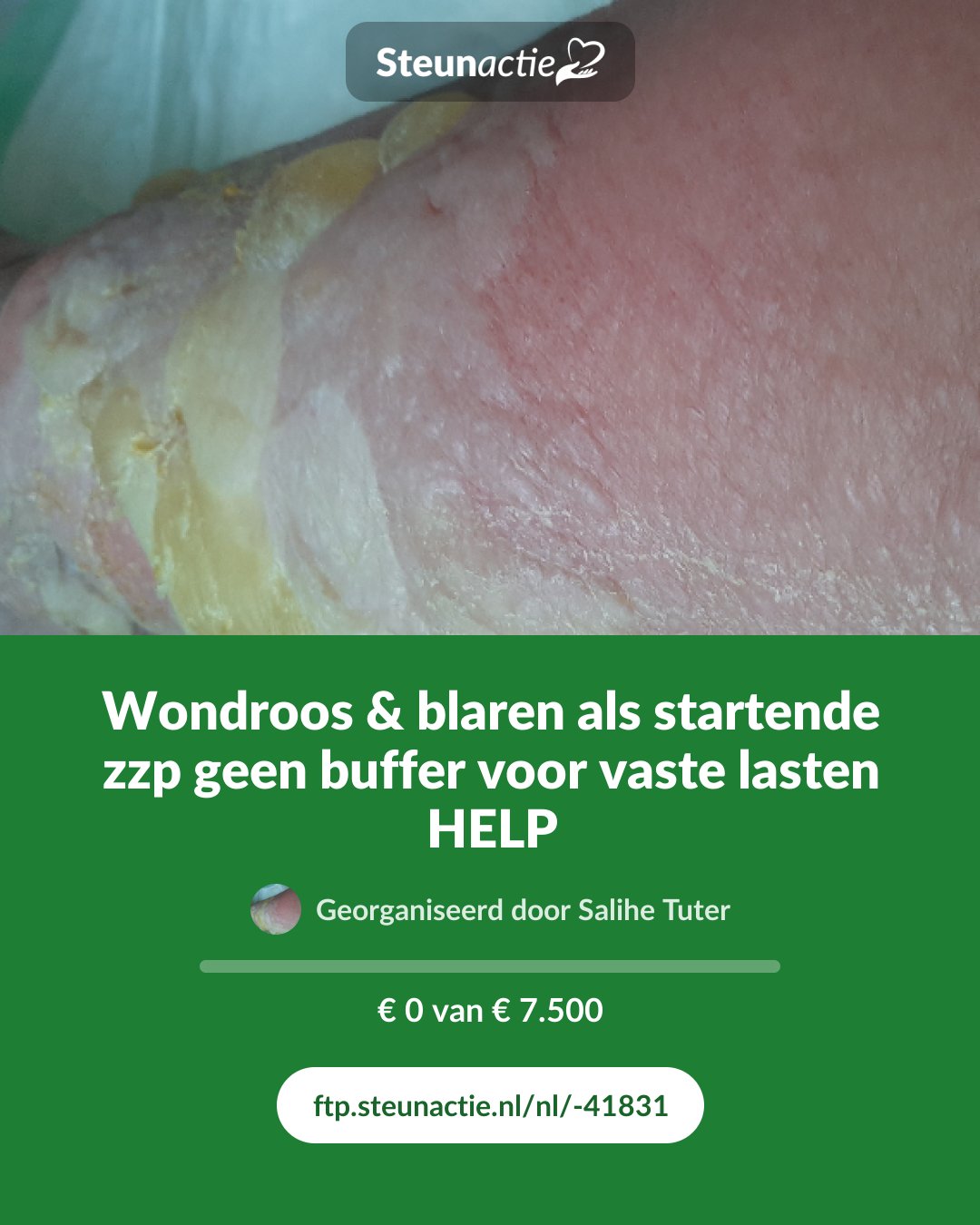 Voorbeeld van de afbeelding