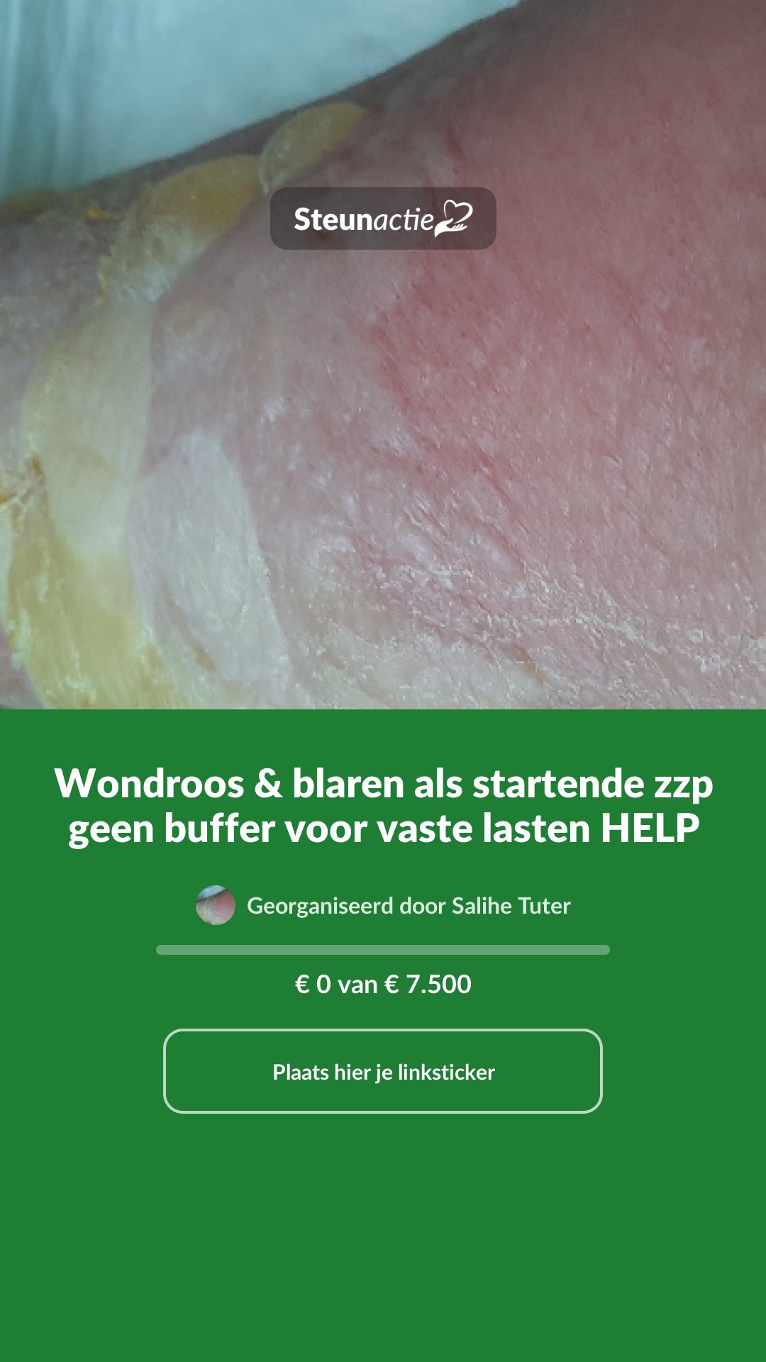 Voorbeeld van de afbeelding