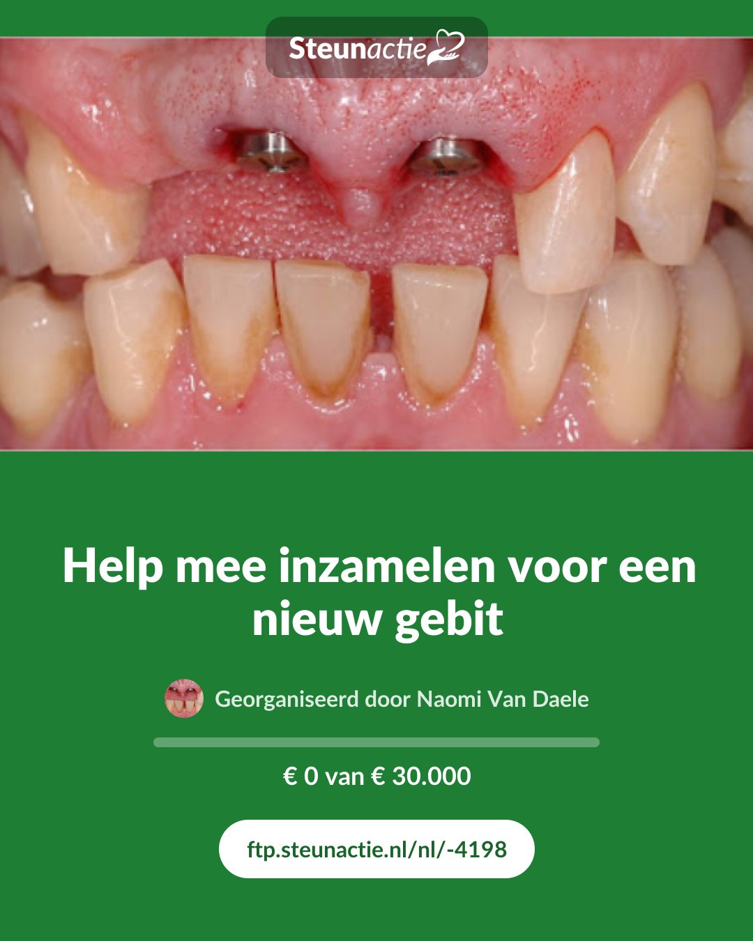 Voorbeeld van de afbeelding