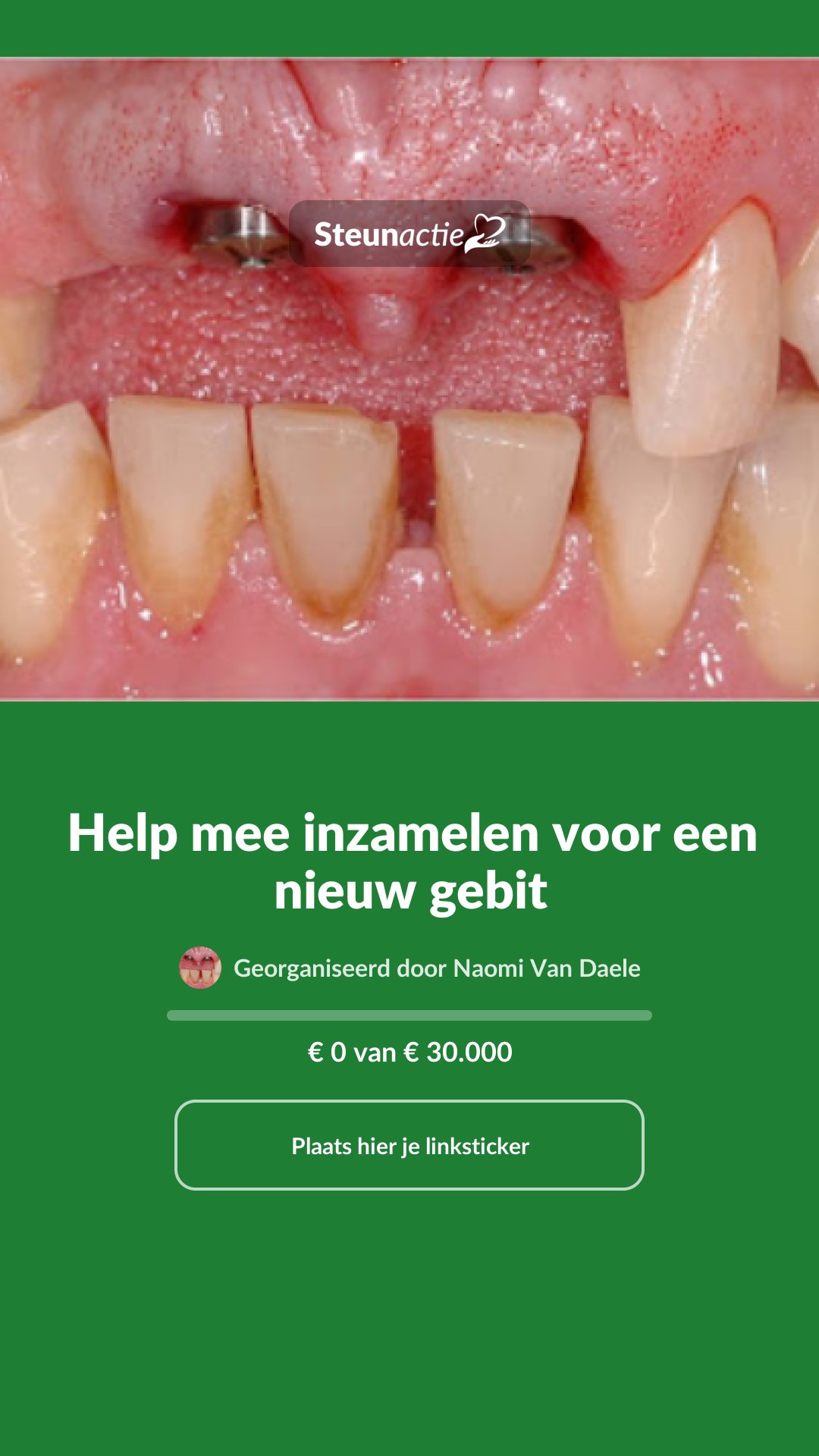 Voorbeeld van de afbeelding