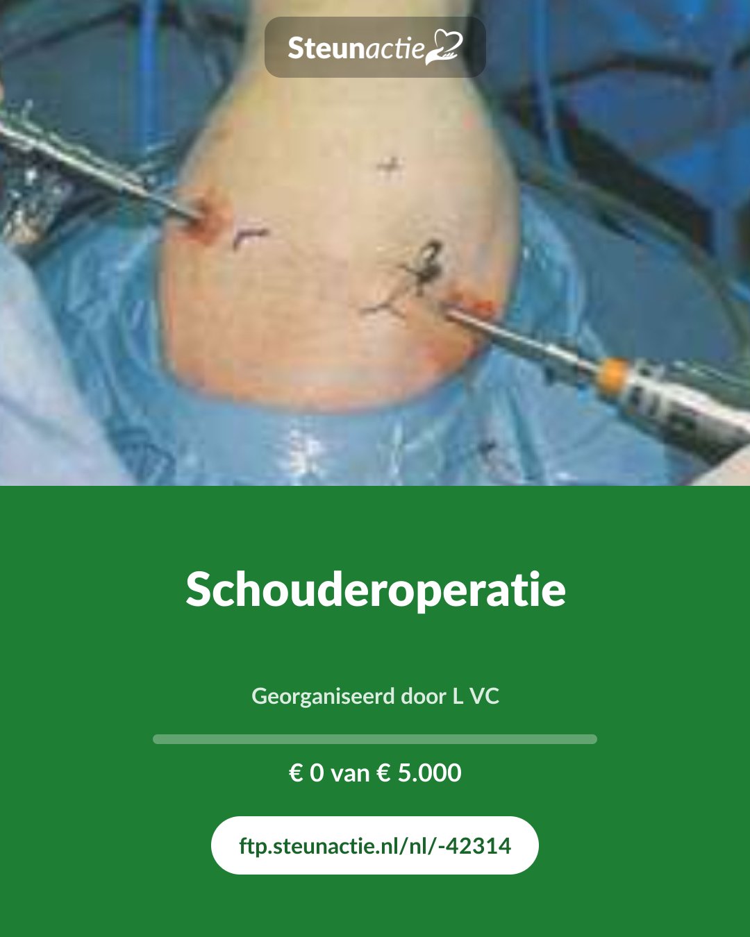 Voorbeeld van de afbeelding