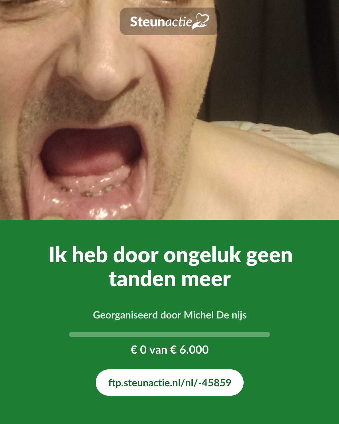 Voorbeeld van de afbeelding