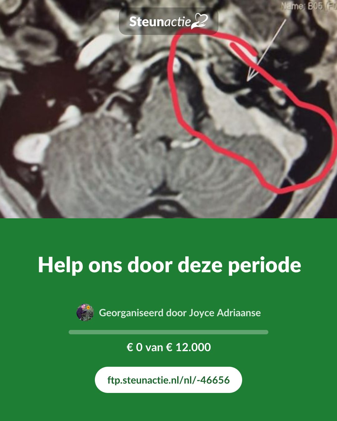 Voorbeeld van de afbeelding