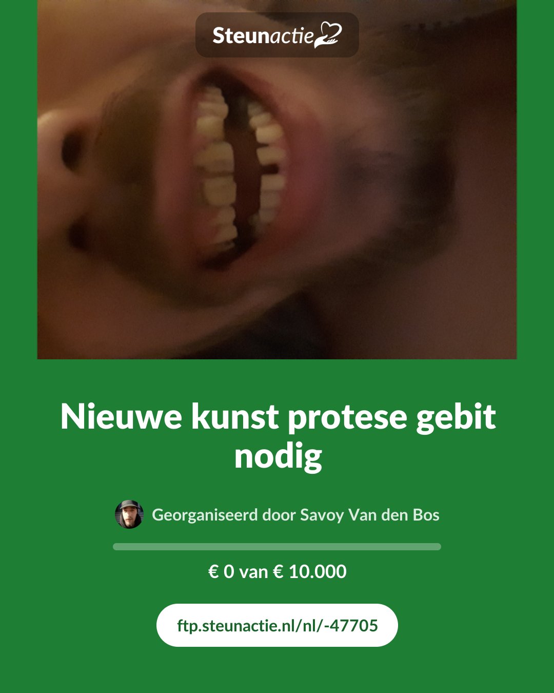 Voorbeeld van de afbeelding