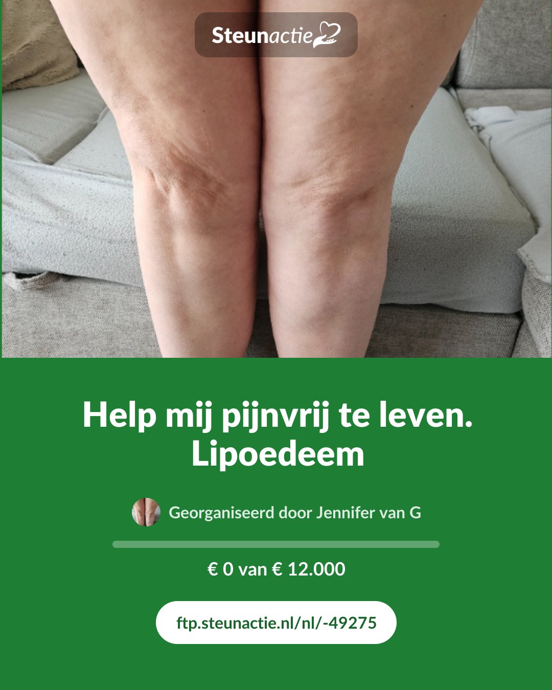 Voorbeeld van de afbeelding
