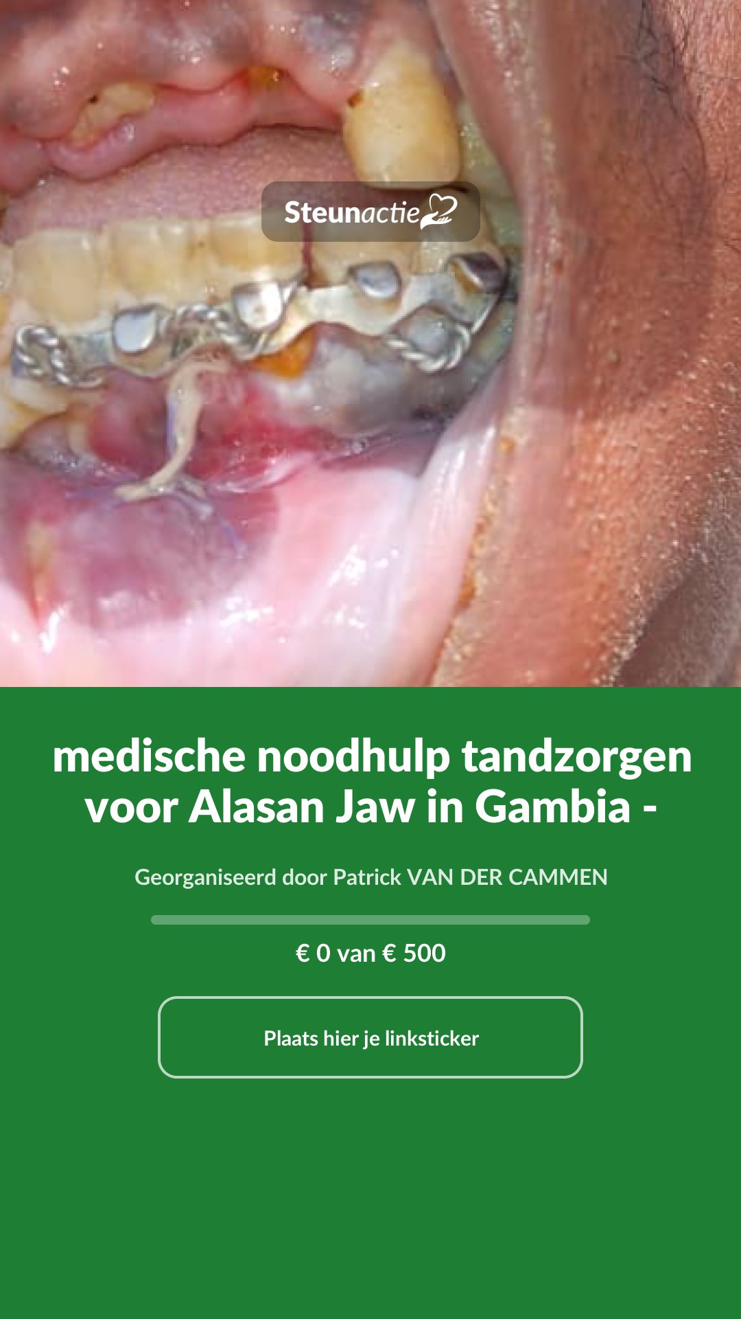 Voorbeeld van de afbeelding