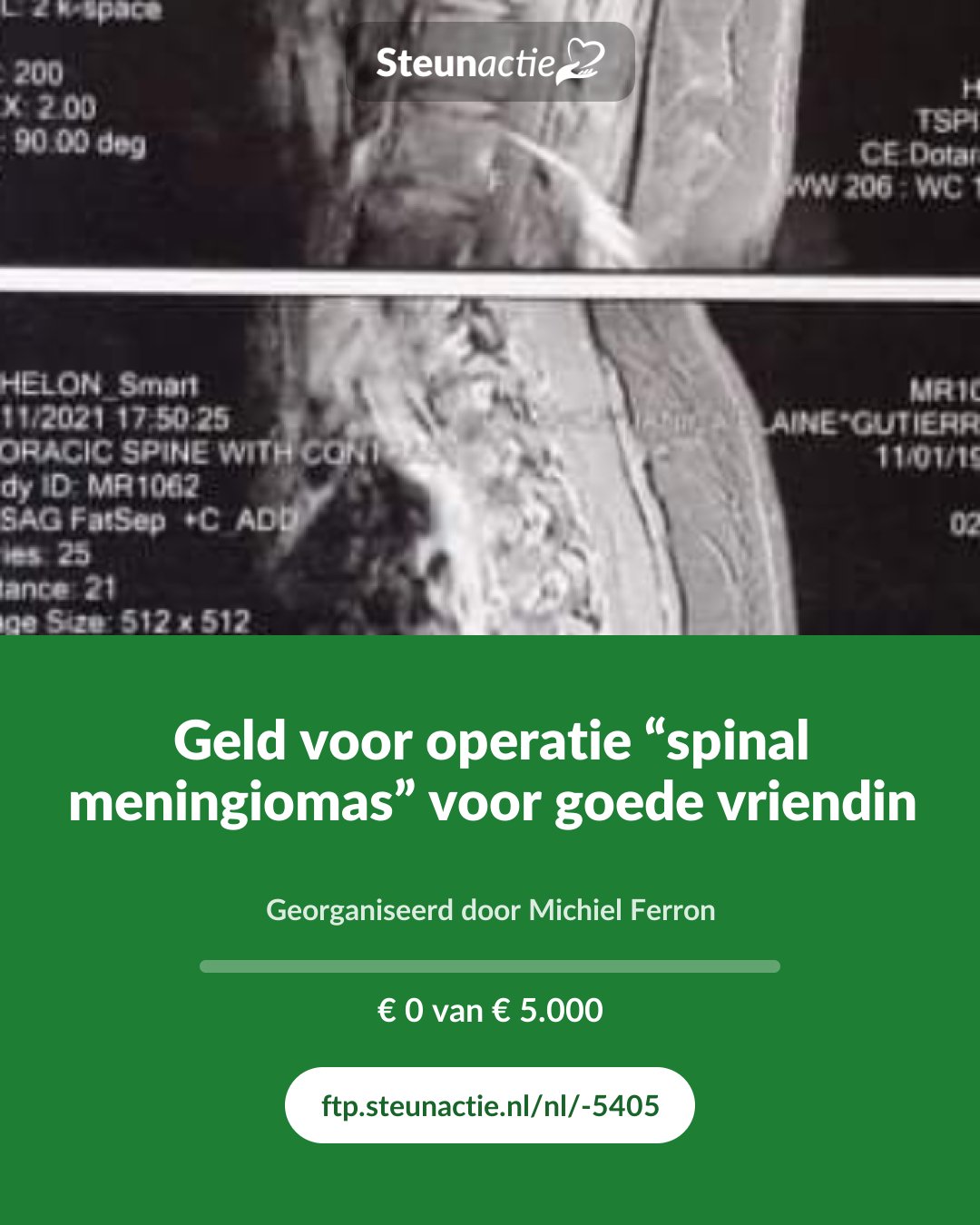 Voorbeeld van de afbeelding