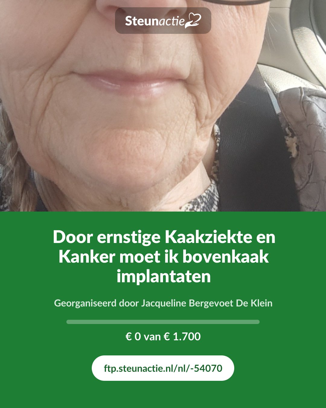 Voorbeeld van de afbeelding