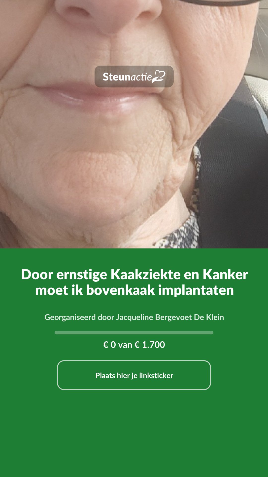 Voorbeeld van de afbeelding
