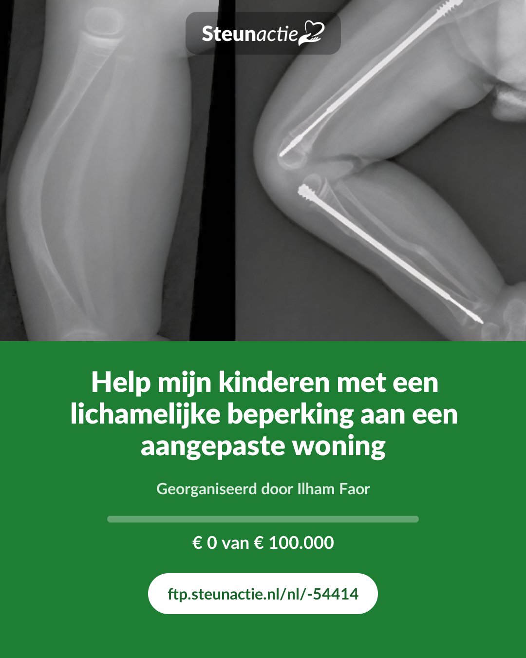Voorbeeld van de afbeelding