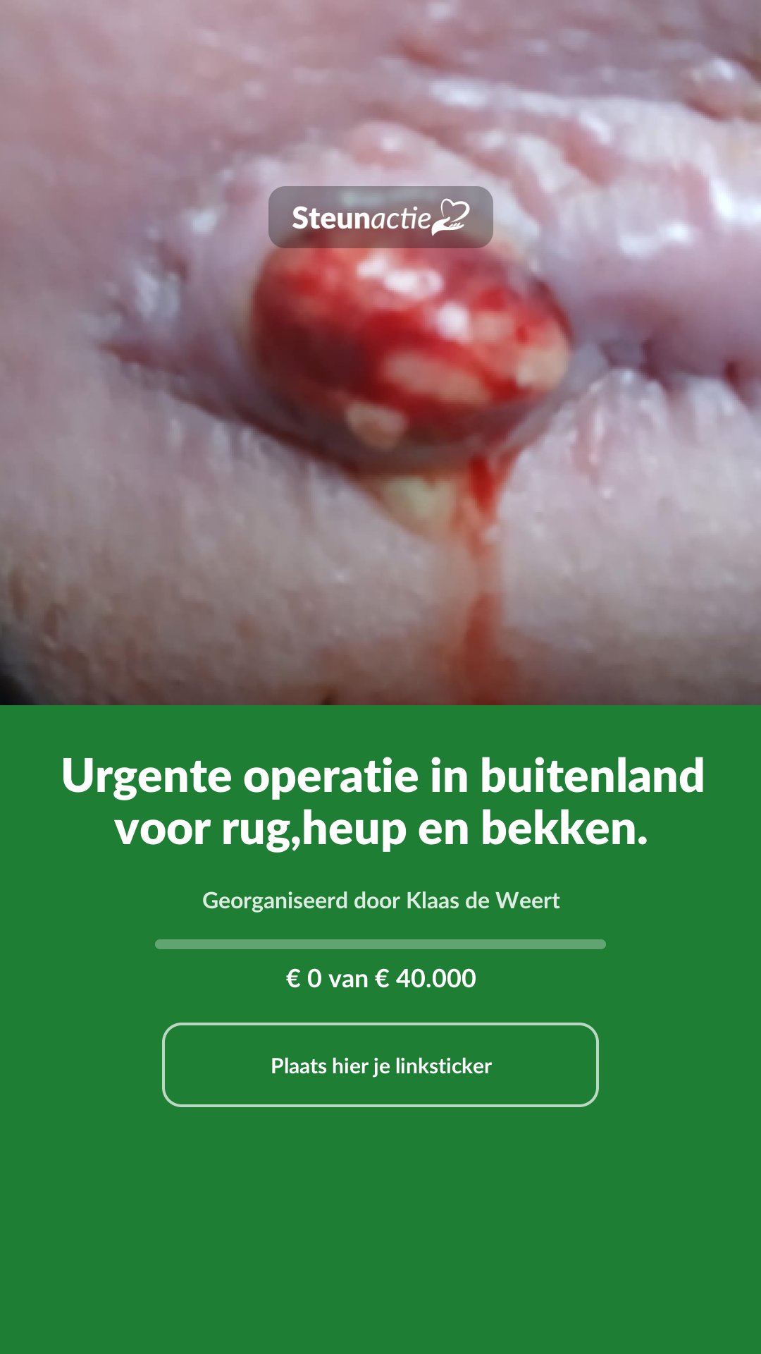 Voorbeeld van de afbeelding