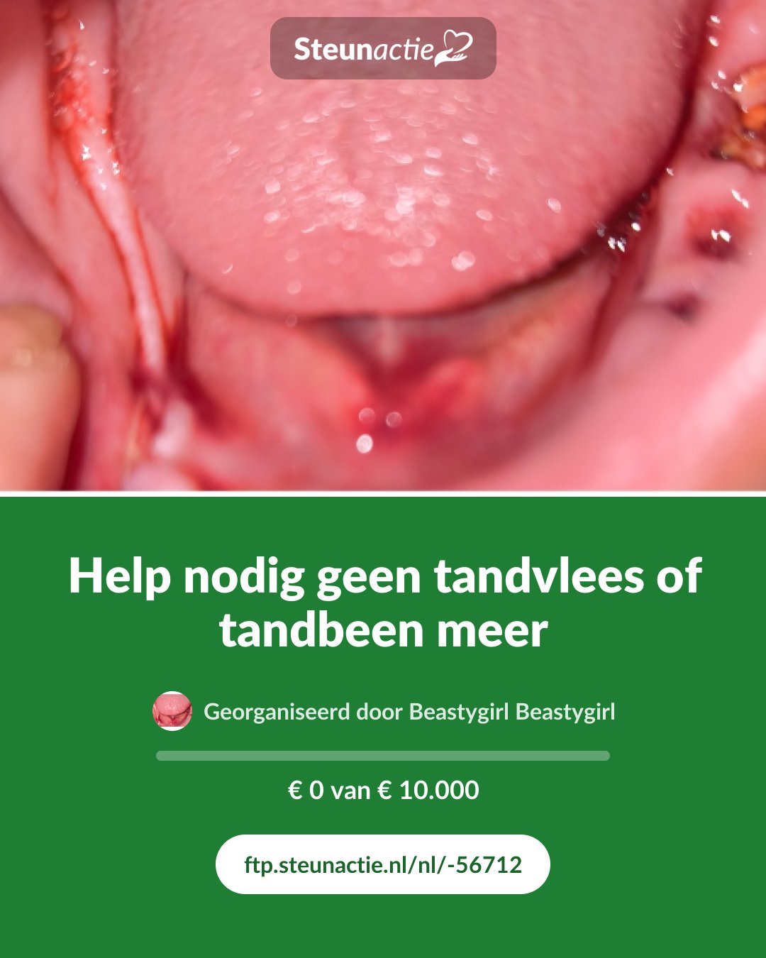 Voorbeeld van de afbeelding