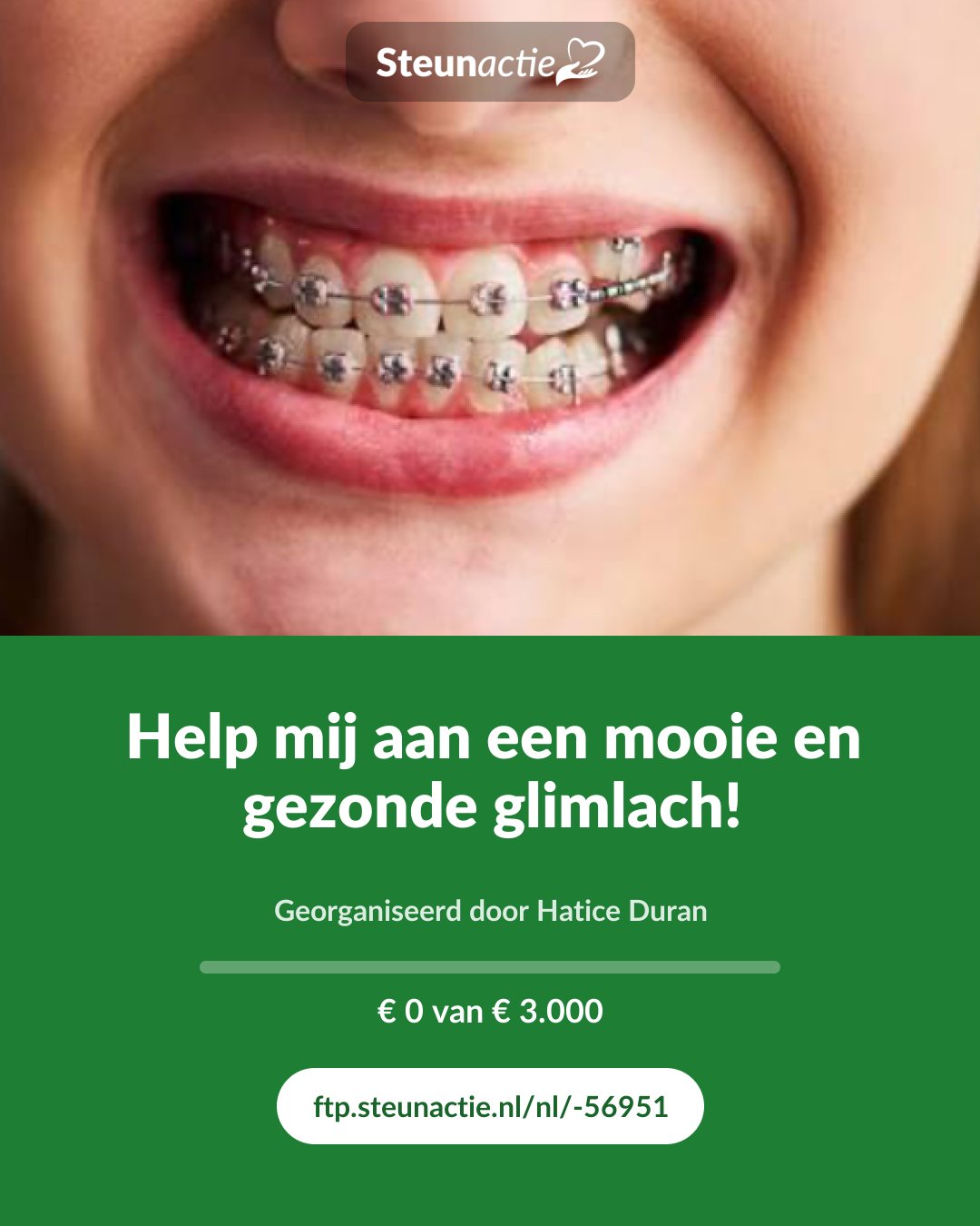 Voorbeeld van de afbeelding