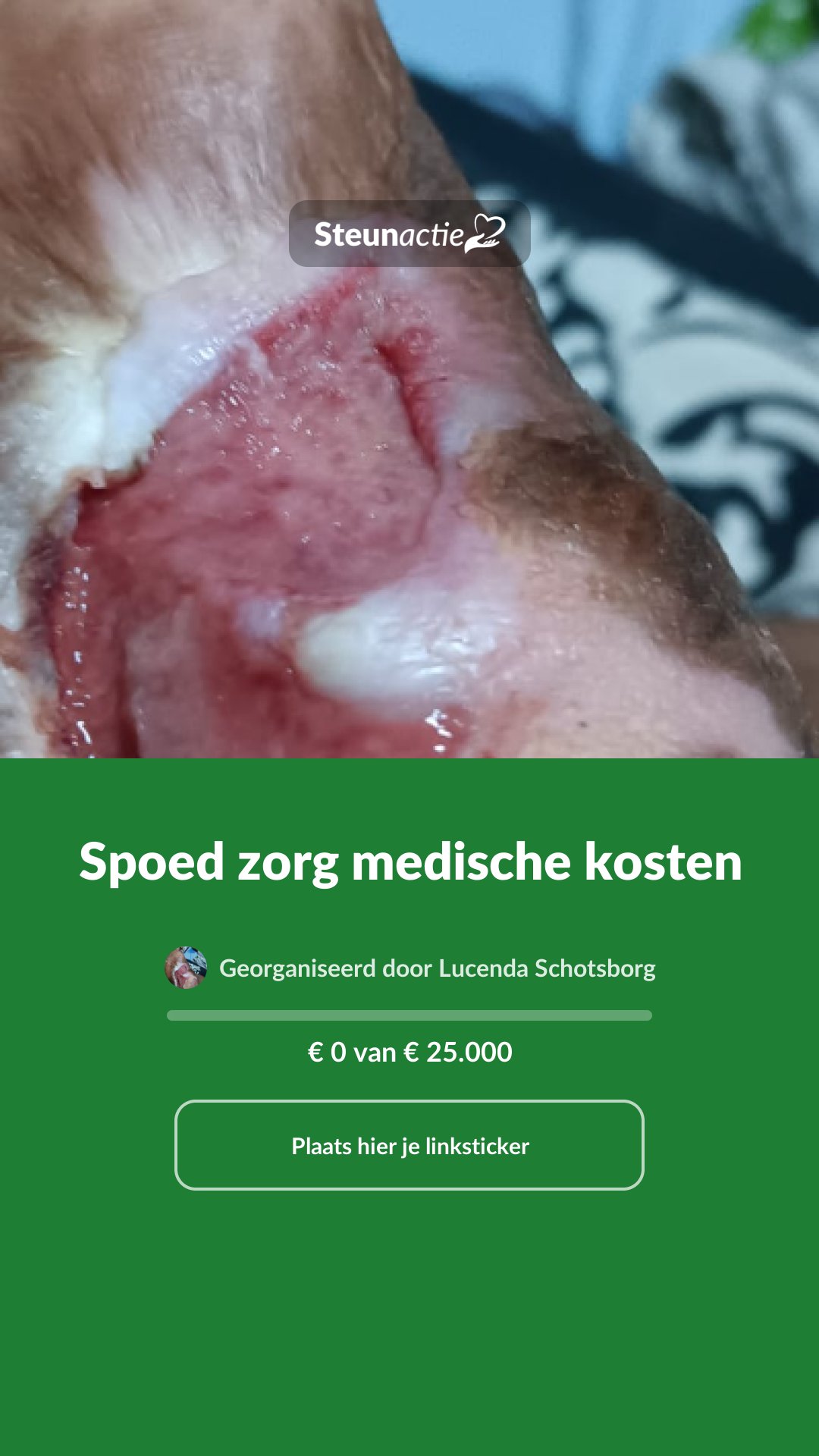 Voorbeeld van de afbeelding