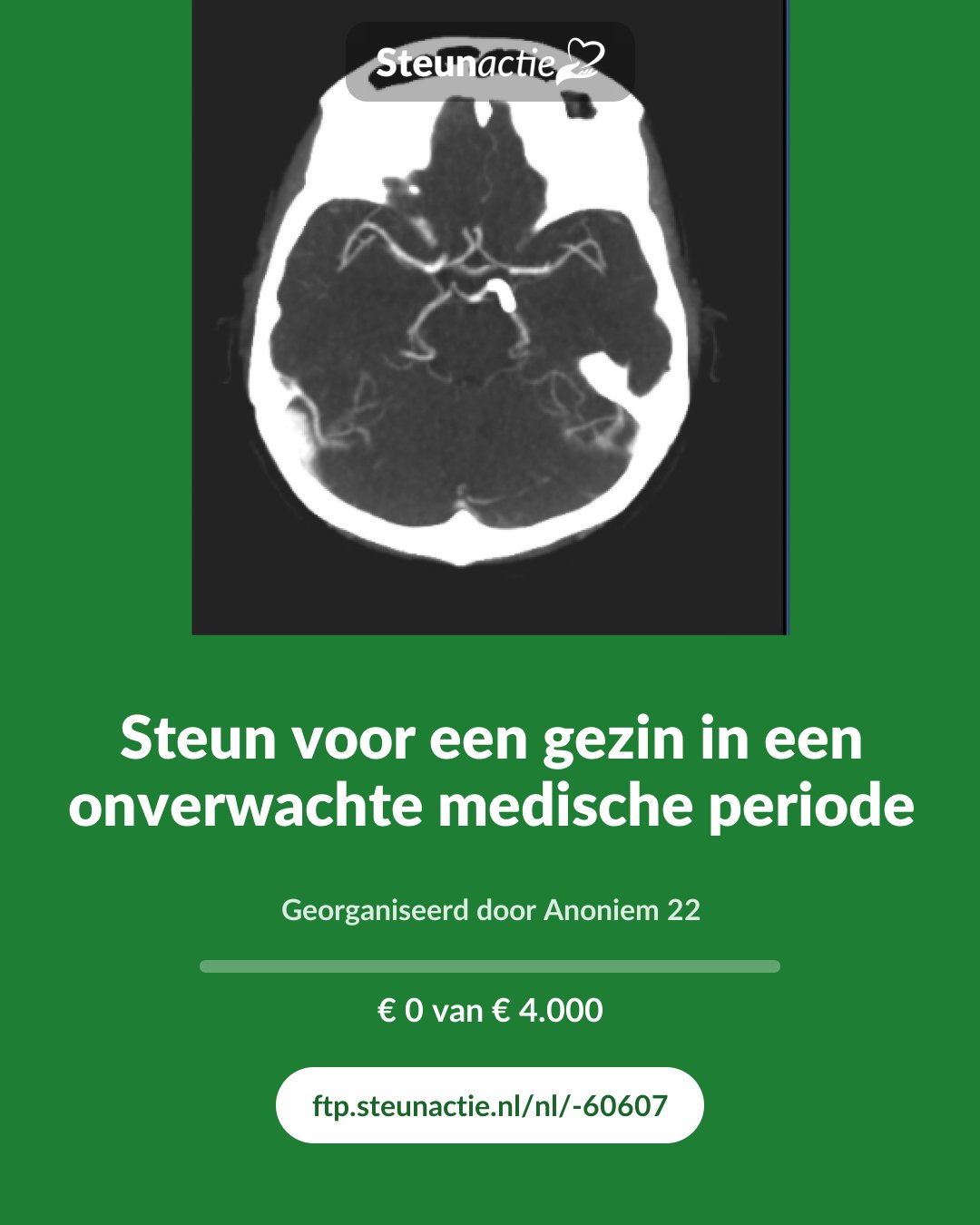 Voorbeeld van de afbeelding