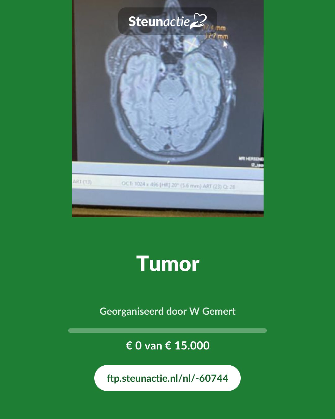 Voorbeeld van de afbeelding