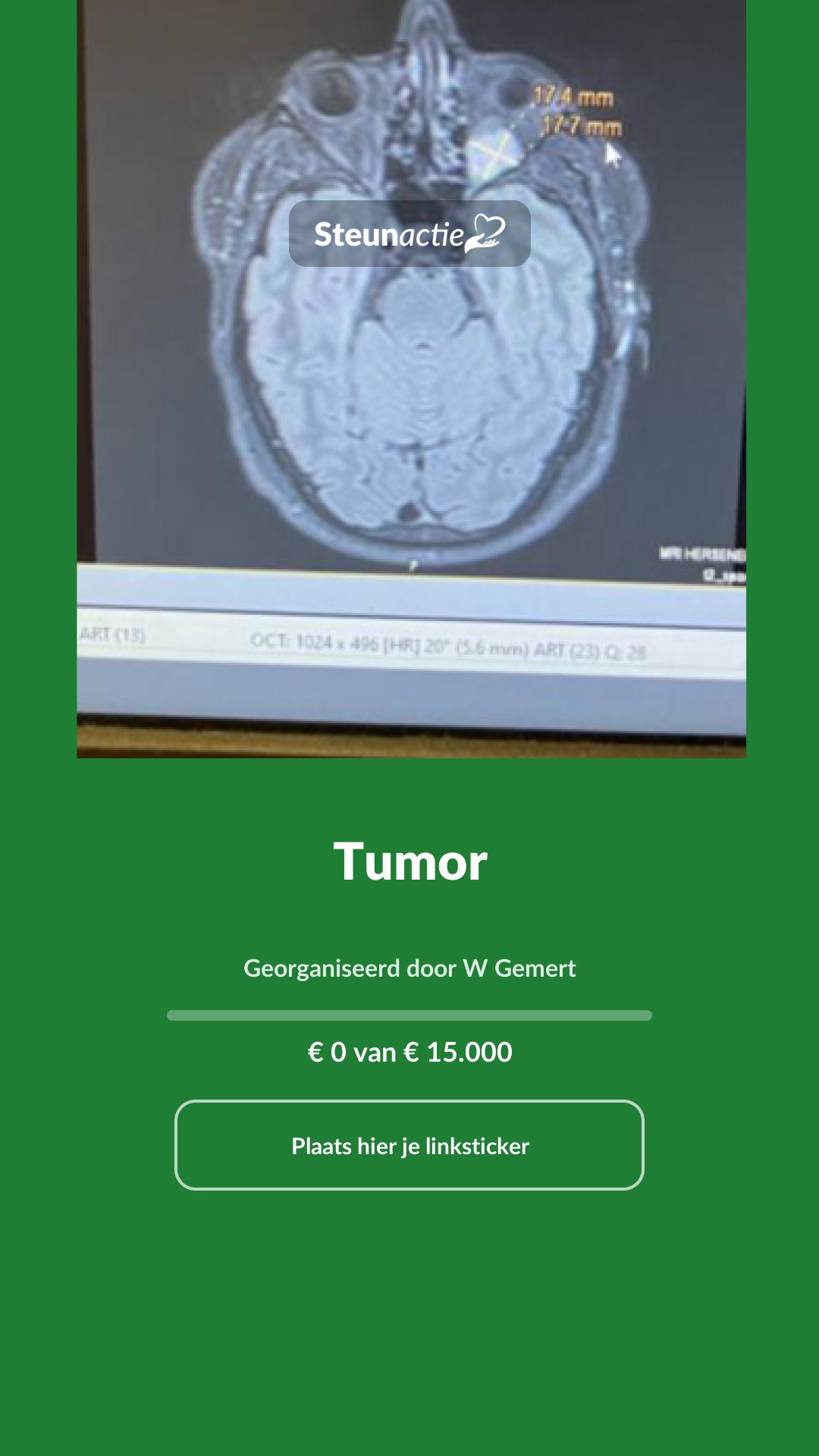 Voorbeeld van de afbeelding
