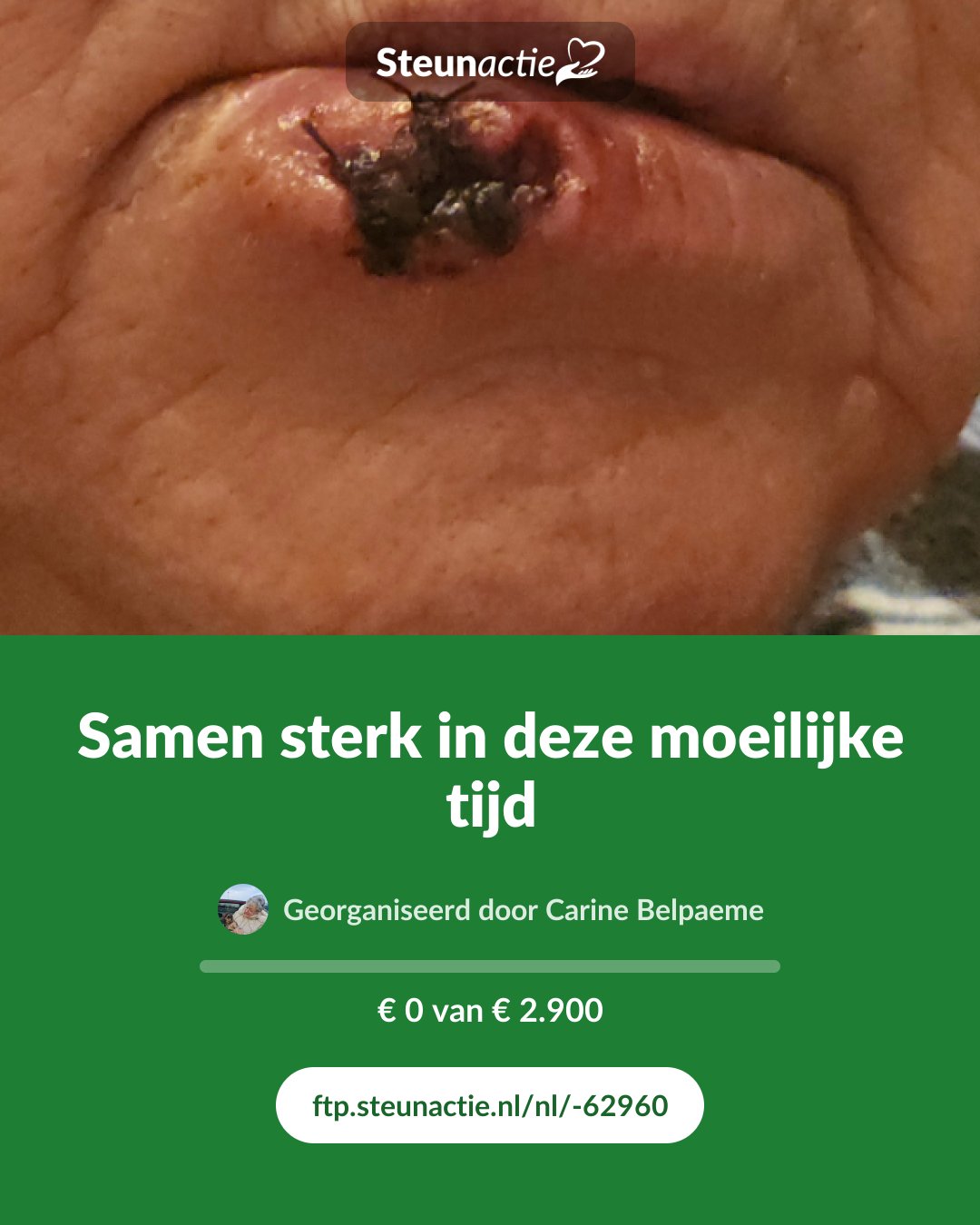 Voorbeeld van de afbeelding