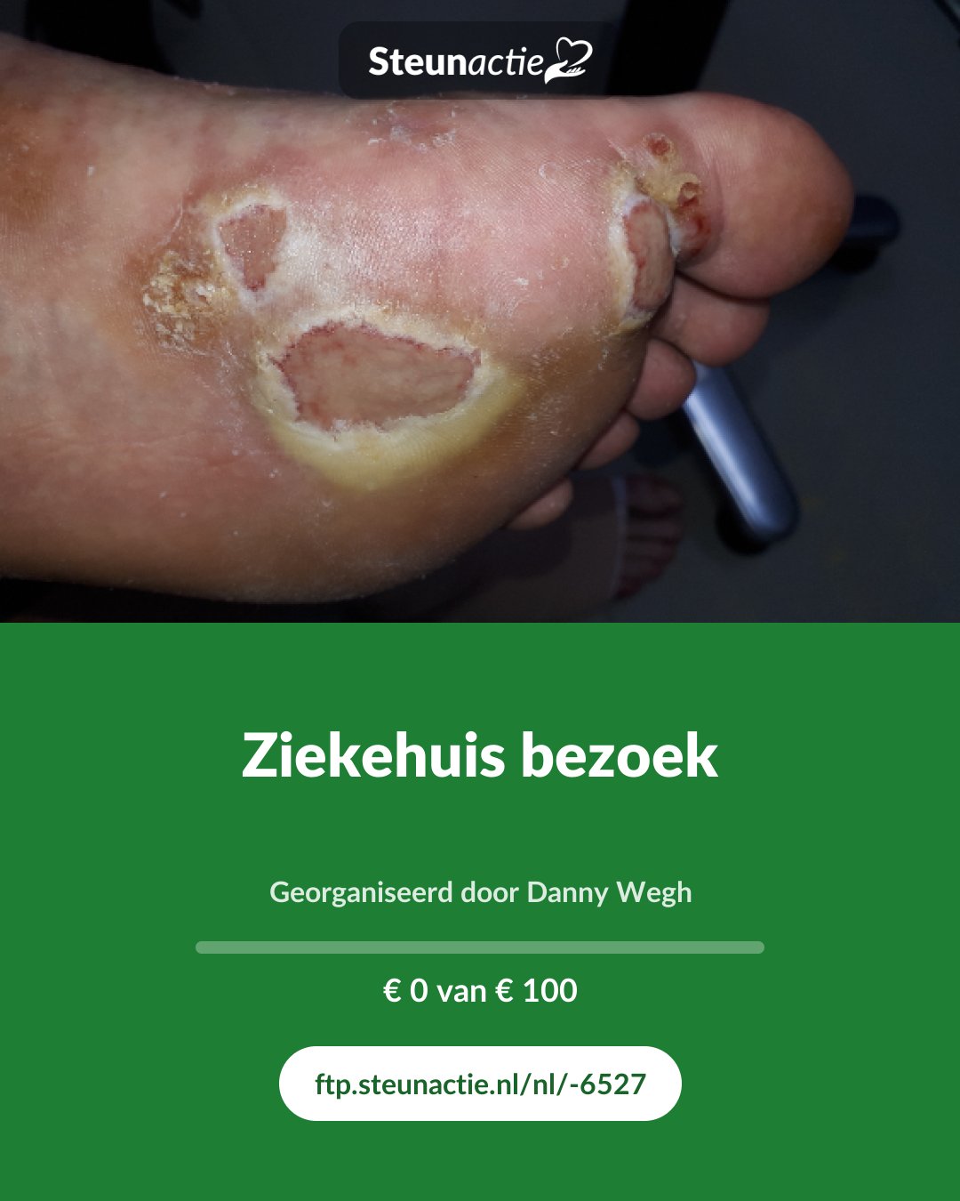 Voorbeeld van de afbeelding
