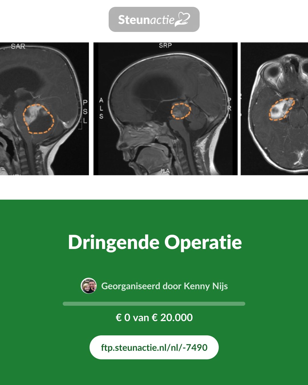 Voorbeeld van de afbeelding