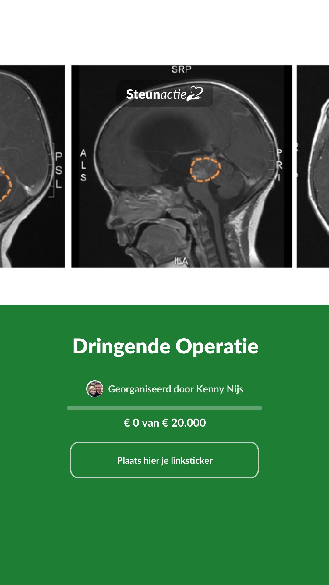 Voorbeeld van de afbeelding