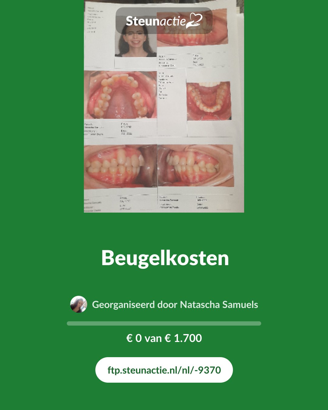 Voorbeeld van de afbeelding
