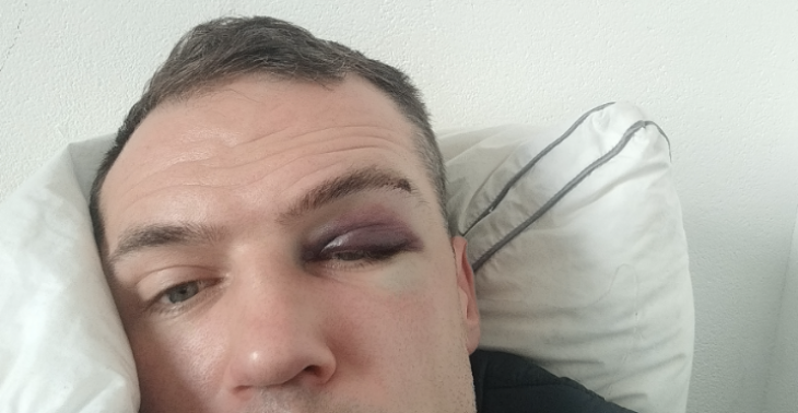 Please help. Suffered many injuries.