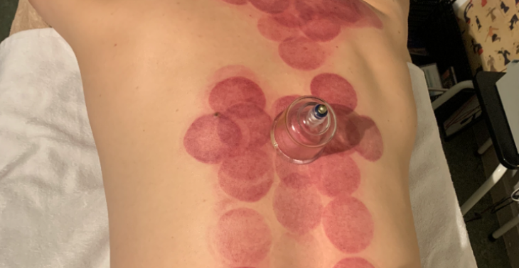 Help mij mijn leven met PTSS draaglijker te maken ?