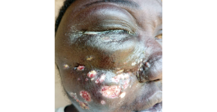 Medical Appeal For Surgery and Treatment