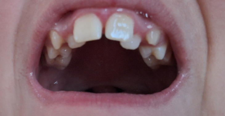 Help! Medische Kosten dreigen een moeder te overweldigen❤️‍🩹