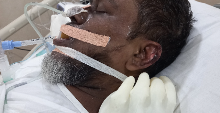 Medisch hulp voor mijn broeder Sepsis probleem in India